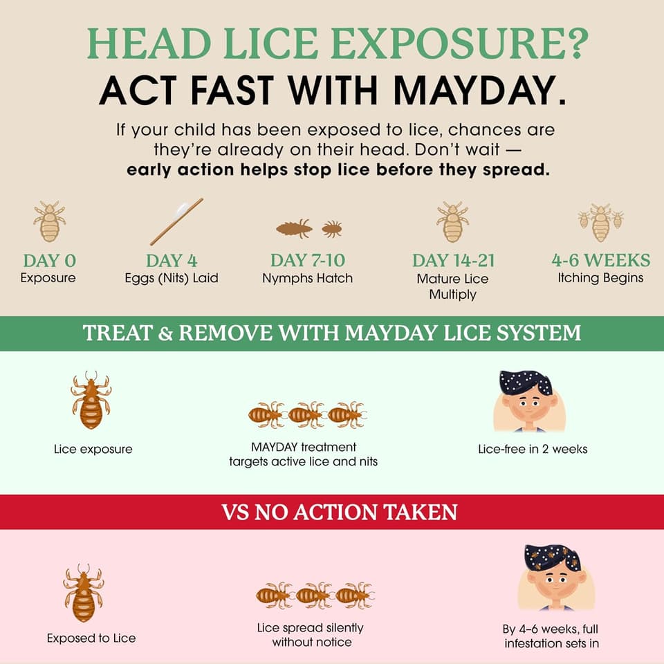 Lice exposure timeline: MAYDAY treatment versus taking no action